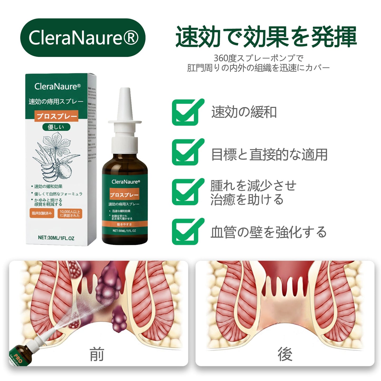 限定キャンペーン | CleraNaure® 速効性痔疾用PROスプレー