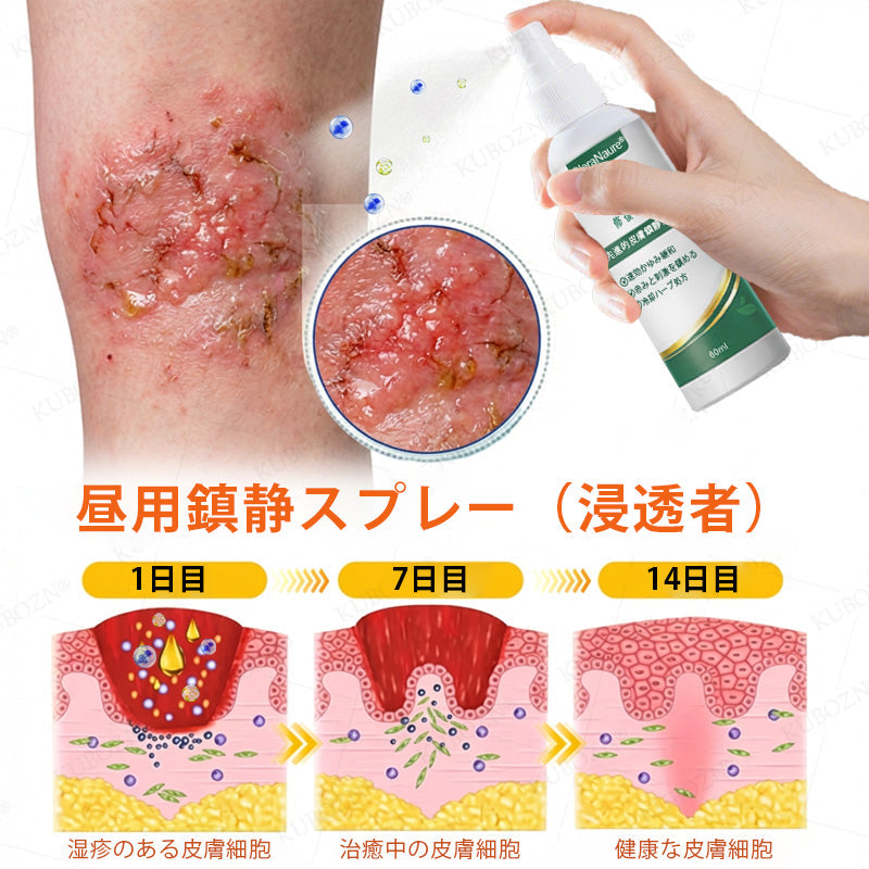 CleraNaure® エクゼマ デイ＆ナイトリペアシステム —— 100％ステロイドフリーのデュオケア 激しいかゆみ・赤み・荒れた肌にダブルでアプローチ🛡️