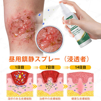 CleraNaure® エクゼマ デイ＆ナイトリペアシステム —— 100％ステロイドフリーのデュオケア 激しいかゆみ・赤み・荒れた肌にダブルでアプローチ🛡️