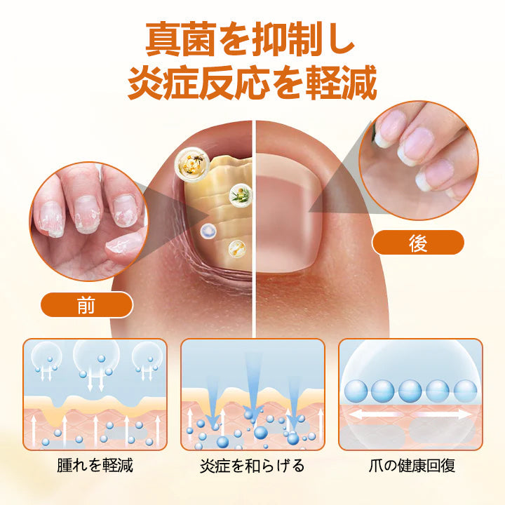 CleraNaure® FungiBee Advanced ネイルリペアスプレー🌟