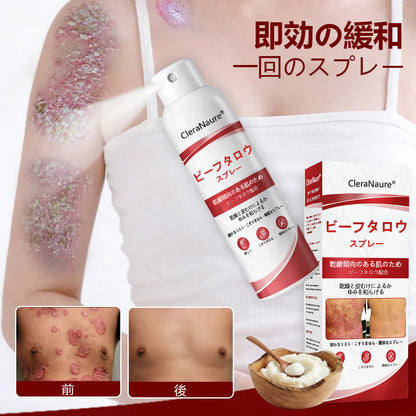 CleraNaure® ビーフタロウスプレー — かゆみ・皮膚の剥がれを抑える乾癬用スキンケアスプレー