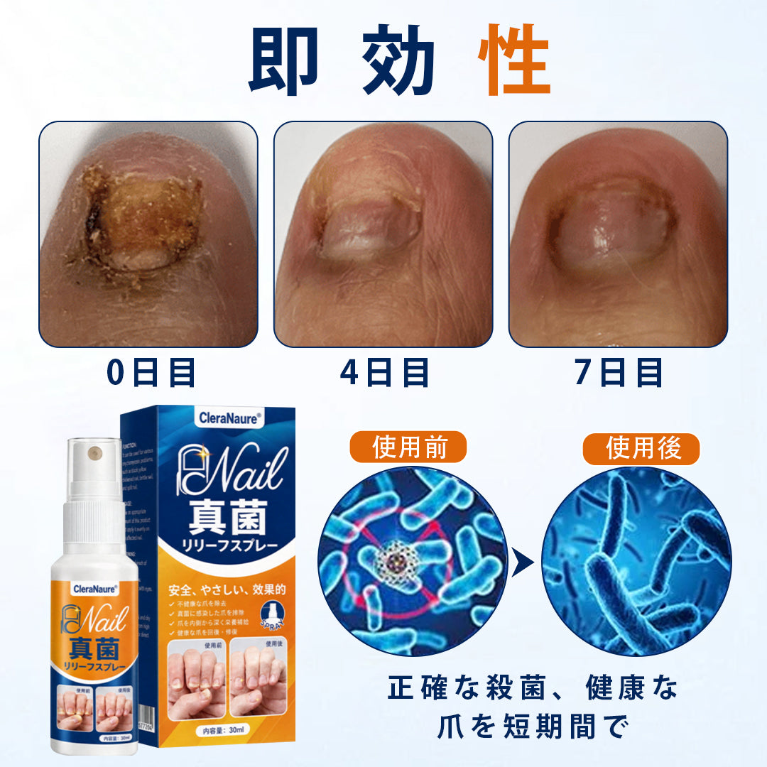 CleraNaure® 爪水虫緩和スプレー