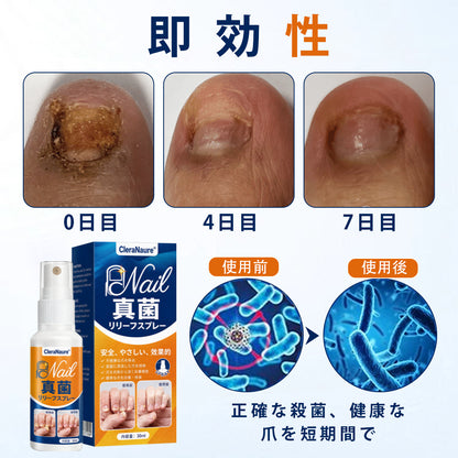 CleraNaure® 爪水虫緩和スプレー