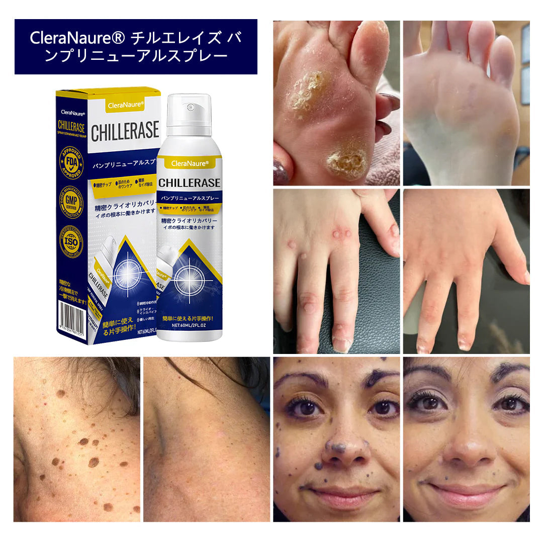 CleraNaure® チルイレイズ バンプ修復スプレー