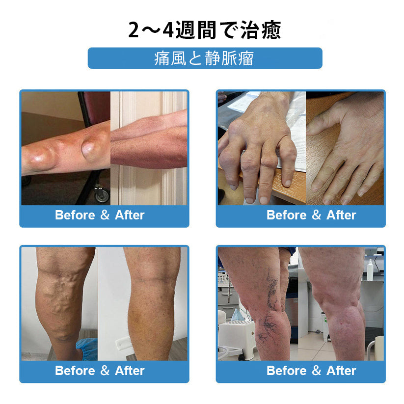 CleraNaure® ナノマイクロニードル関節用パッチ