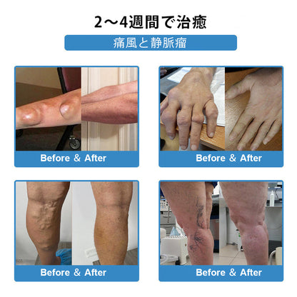 CleraNaure® ナノマイクロニードル関節用パッチ