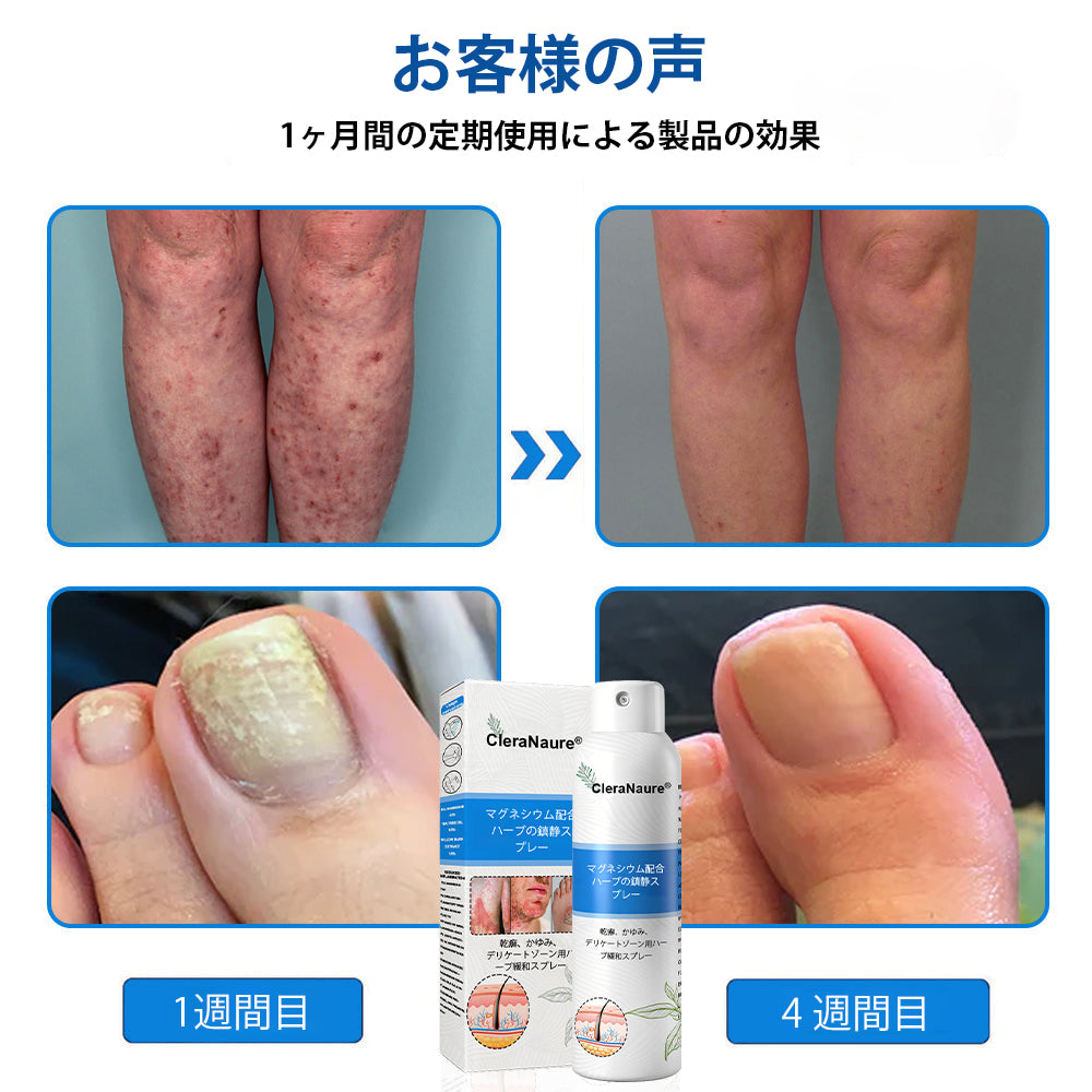 CleraNaure® マグネシウム＆ボタニカルスプレー – 乾癬・湿疹にアプローチする先進のスキンリカバリー | ステロイドフリーで即効鎮静