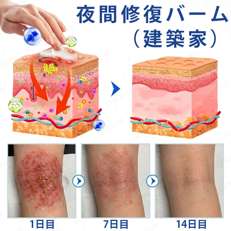 CleraNaure® エクゼマ デイ＆ナイトリペアシステム —— 100％ステロイドフリーのデュオケア 激しいかゆみ・赤み・荒れた肌にダブルでアプローチ🛡️