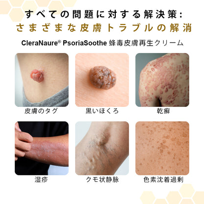 CleraNaure® プソリアスーズ ミツバチ毒配合スキンリストアクリーム💎