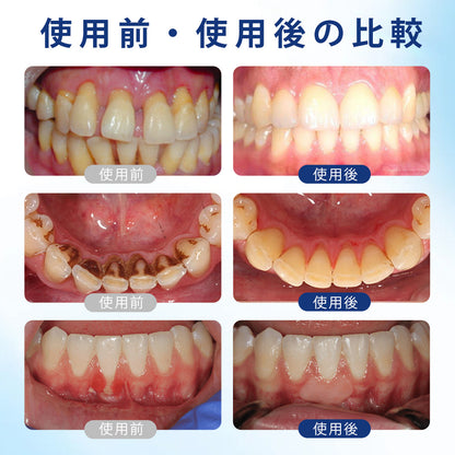 COLTURE® ガムハニー オーラルリペアドロップス
