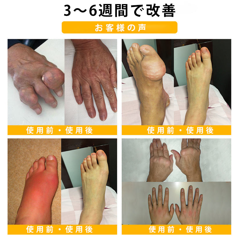 CleraNaure® ボツリヌストキシン＆蜂毒配合 鎮痛・骨癒合クリーム🍀