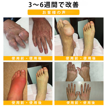 CleraNaure® ボツリヌストキシン＆蜂毒配合 鎮痛・骨癒合クリーム🍀