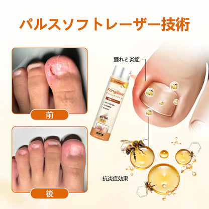 CleraNaure® FungiBee Advanced ネイルリペアスプレー🌟