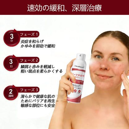 CleraNaure® ビーフタロウスプレー — かゆみ・皮膚の剥がれを抑える乾癬用スキンケアスプレー