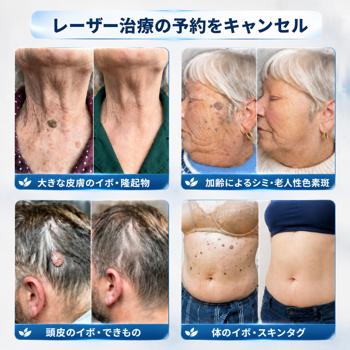 薬剤師もおすすめ💛 𝑯𝗲𝙖𝐥𝒓𝗶𝙯𝗲® 7日間 タグ＆スポットイレーサー🪄 （痛みゼロ・傷あとゼロを目指すローラーボールタイプ）👩‍⚕️