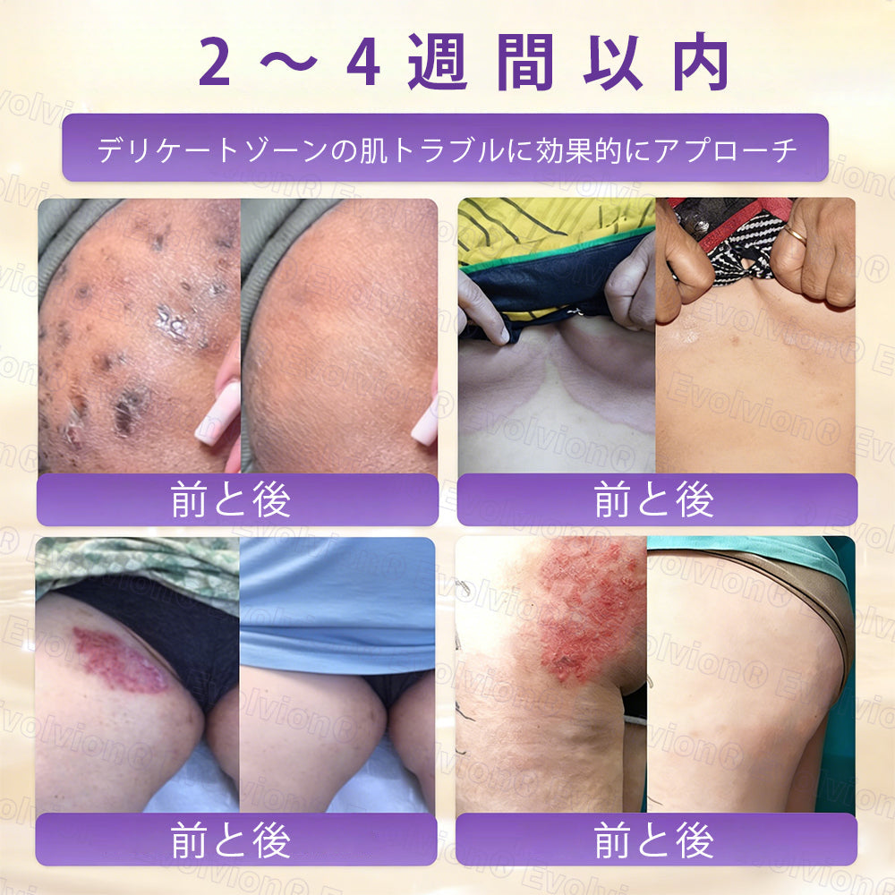 CleraNaure® ビオチン10-in-1 スキンリストアクリーム