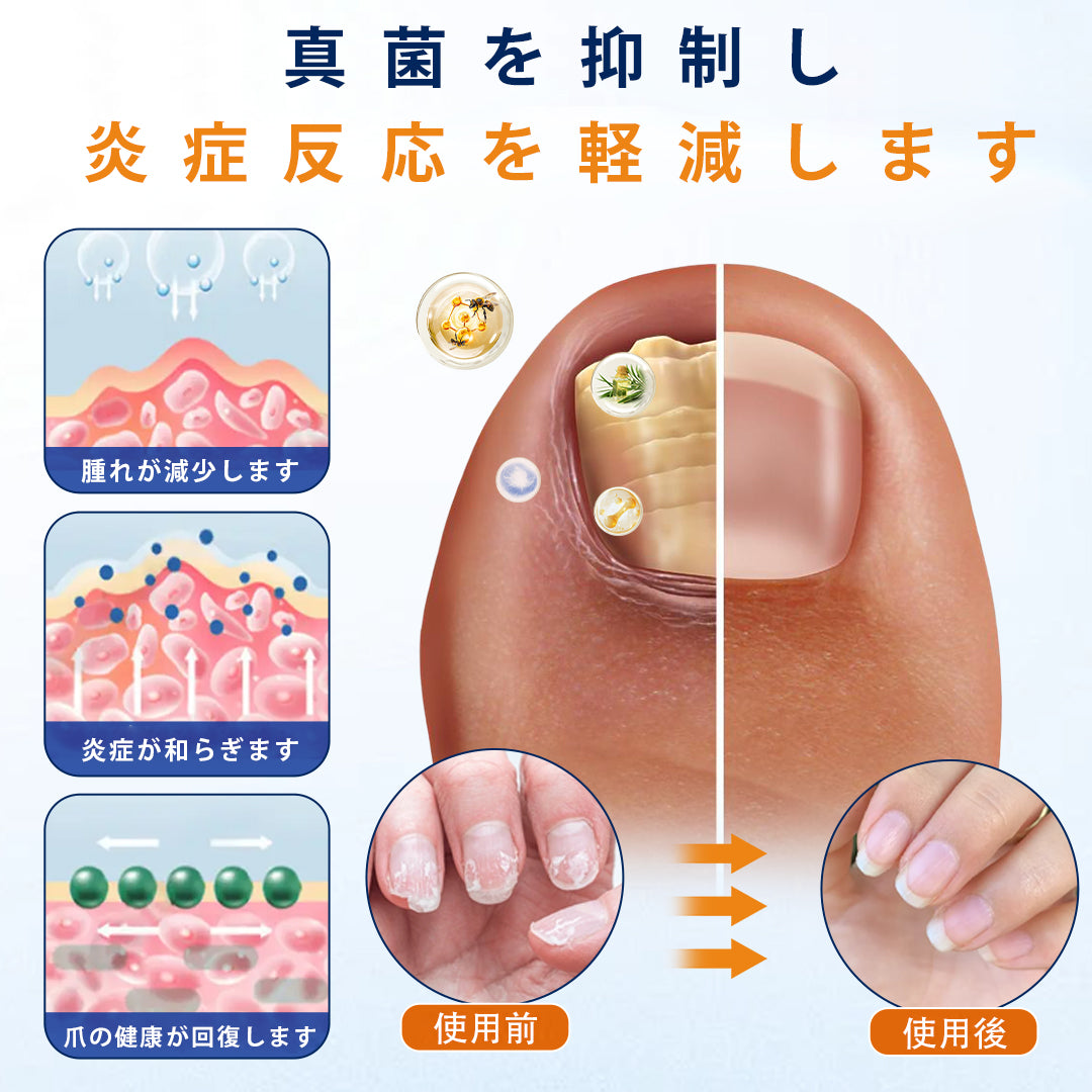 CleraNaure® 爪水虫緩和スプレー