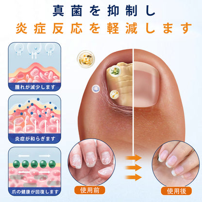 CleraNaure® 爪水虫緩和スプレー
