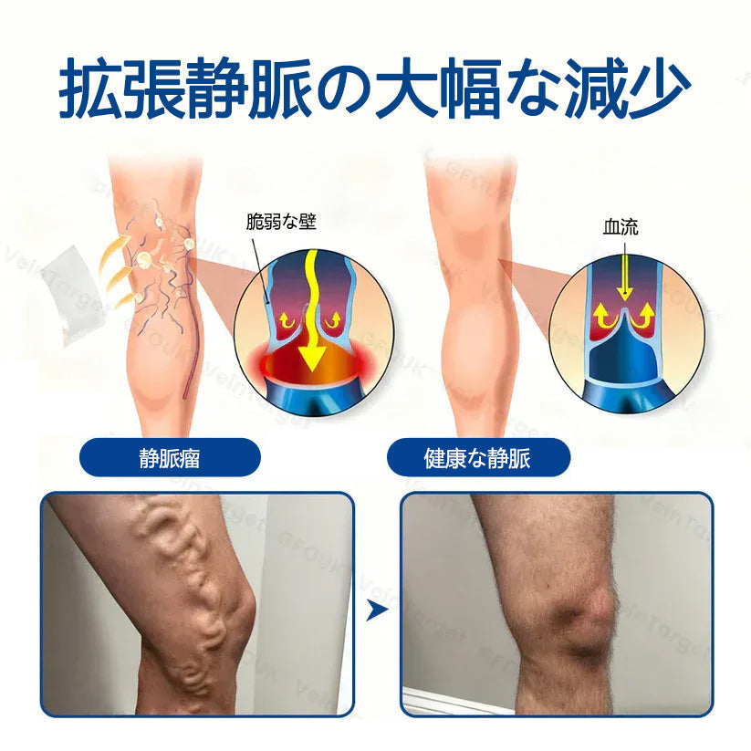 Healrize® ヴェインターゲット マイクロニードルパッチ✨🥇