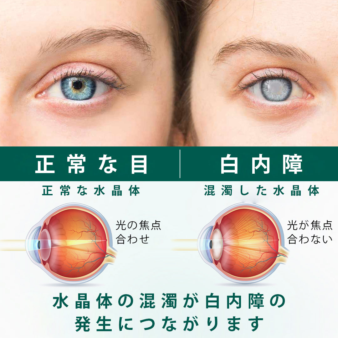 🛡️CleraNaure® オプティクリア ナノアイローラーセラム