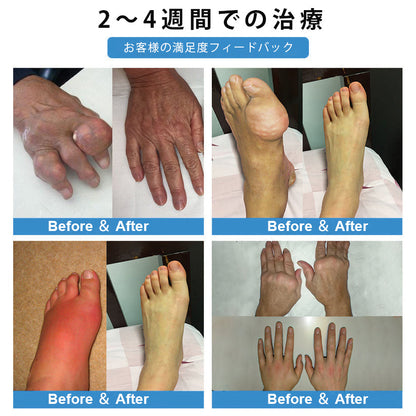 CleraNaure® ナノマイクロニードル関節用パッチ