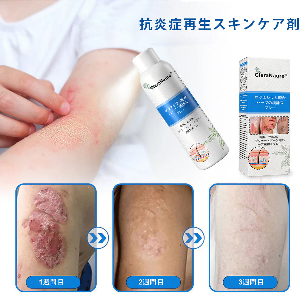 CleraNaure® マグネシウム＆ボタニカルスプレー – 乾癬・湿疹にアプローチする先進のスキンリカバリー | ステロイドフリーで即効鎮静