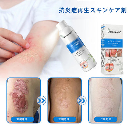 CleraNaure® マグネシウム＆ボタニカルスプレー – 乾癬・湿疹にアプローチする先進のスキンリカバリー | ステロイドフリーで即効鎮静