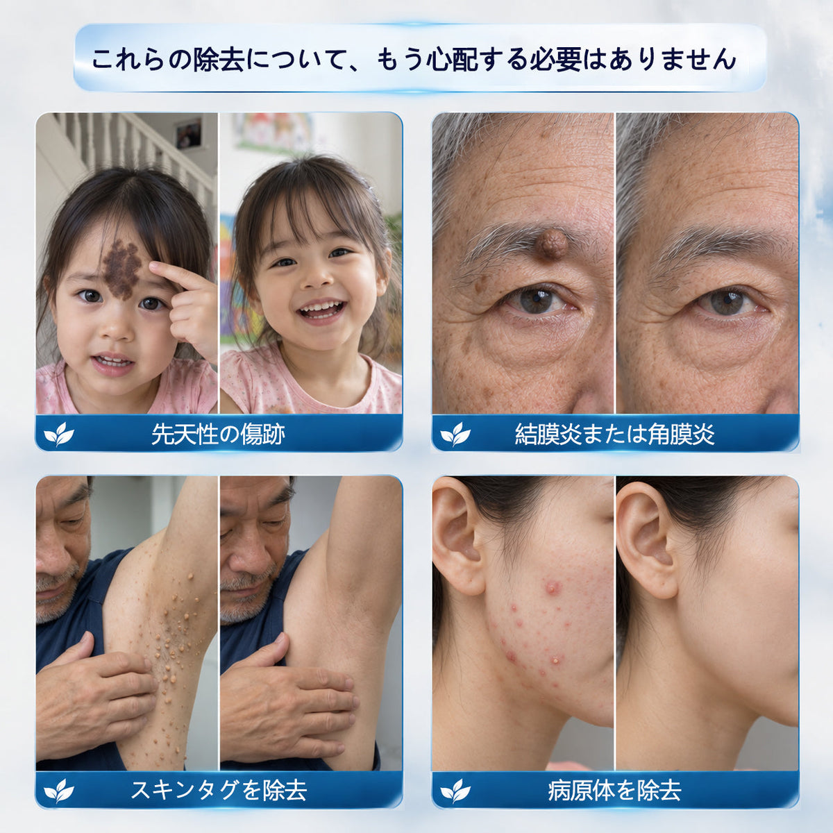 CleraNaure® 7日間スキンタグ＆スポット消去クリーム（痛みゼロ・傷跡ゼロ処方）