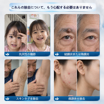 CleraNaure® 7日間スキンタグ＆スポット消去クリーム（痛みゼロ・傷跡ゼロ処方）