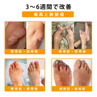 CleraNaure® ボツリヌストキシン＆蜂毒配合 鎮痛・骨癒合クリーム🍀
