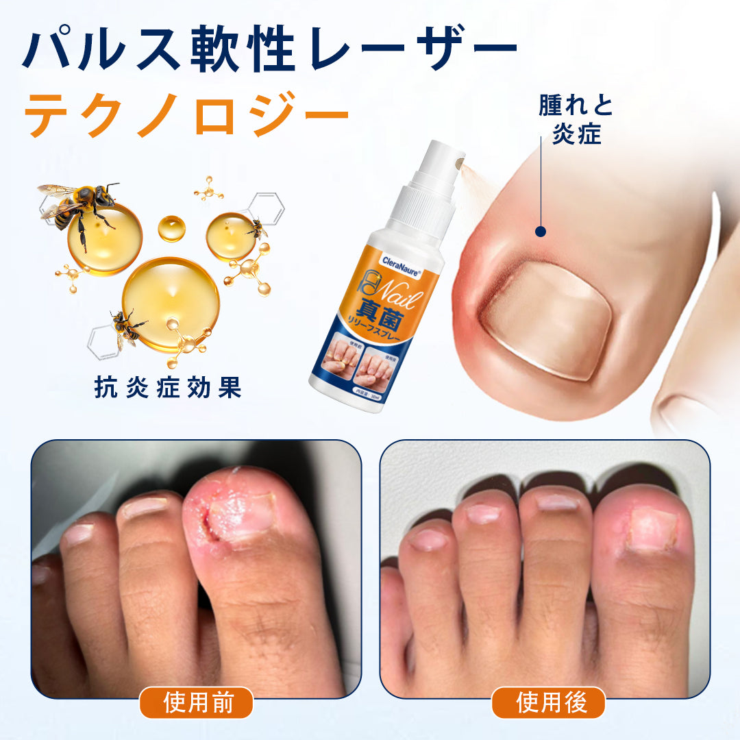 CleraNaure® 爪水虫緩和スプレー