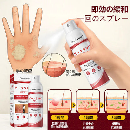 CleraNaure® ビーフタロウスプレー — かゆみ・皮膚の剥がれを抑える乾癬用スキンケアスプレー