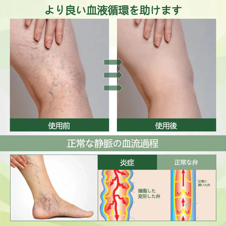 CleraNaure® FluidEase 脚の血行促進用プロフェッショナルクリームが本物の安心感をお届けします！