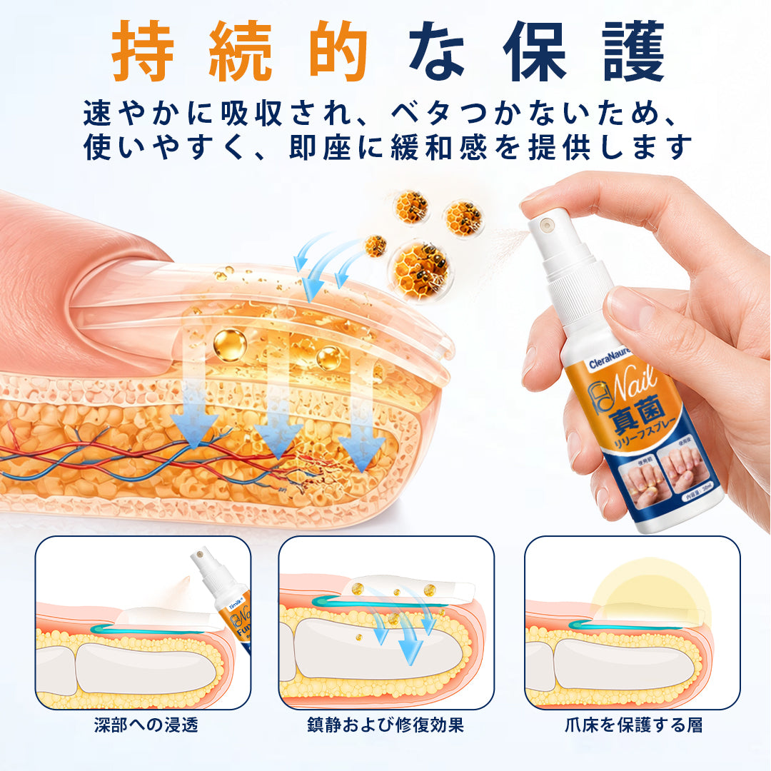CleraNaure® 爪水虫緩和スプレー
