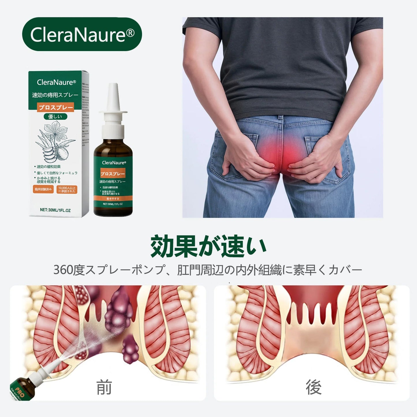 限定キャンペーン | CleraNaure® 速効性痔疾用PROスプレー
