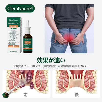 限定キャンペーン | CleraNaure® 速効性痔疾用PROスプレー
