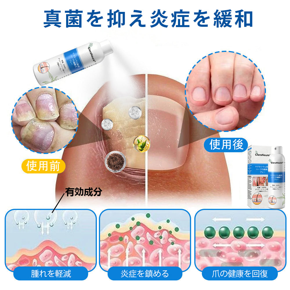 CleraNaure® マグネシウム＆ボタニカルスプレー – 乾癬・湿疹にアプローチする先進のスキンリカバリー | ステロイドフリーで即効鎮静