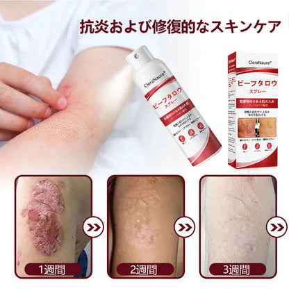 CleraNaure® ビーフタロウスプレー — かゆみ・皮膚の剥がれを抑える乾癬用スキンケアスプレー