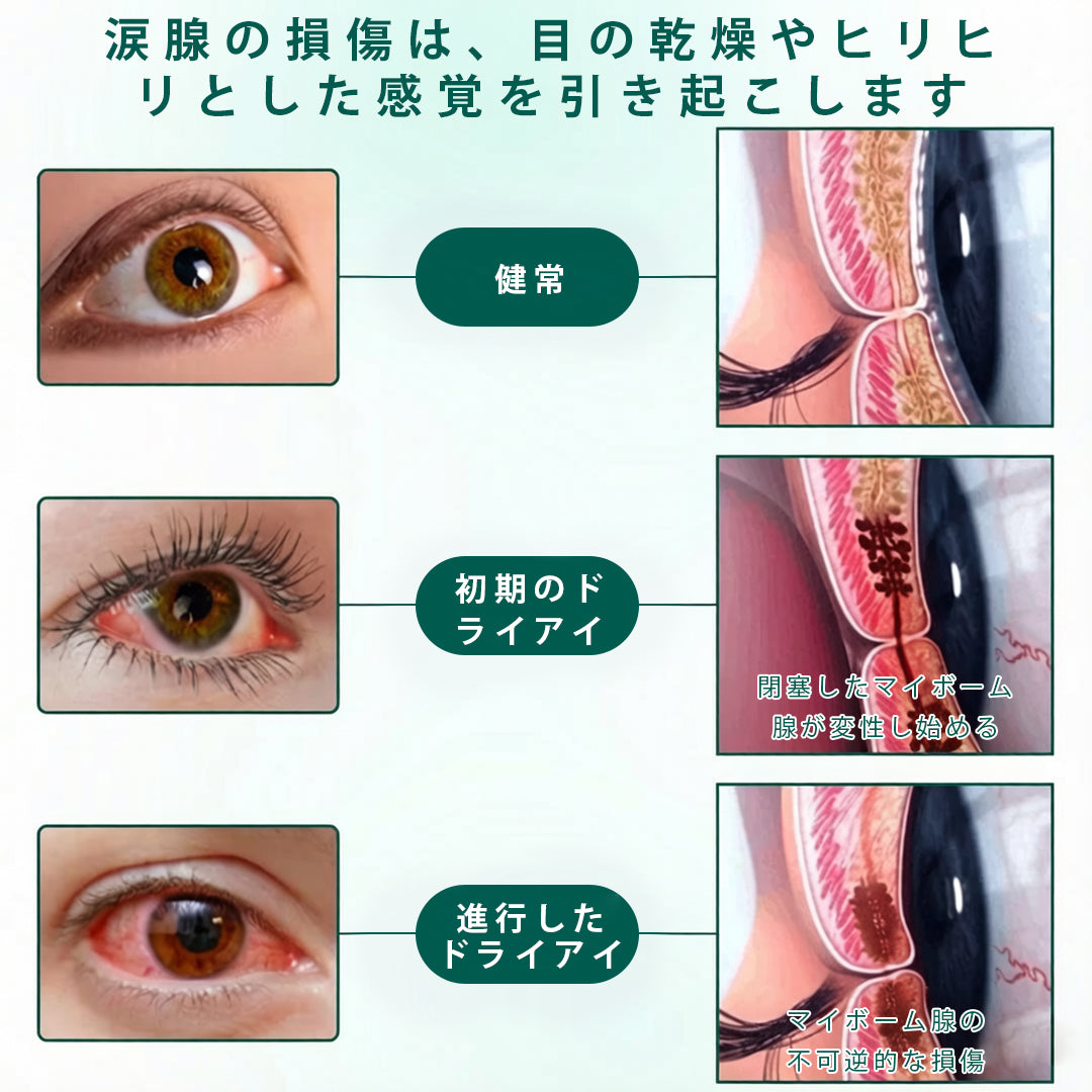 🛡️CleraNaure® オプティクリア ナノアイローラーセラム