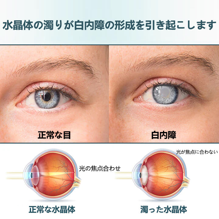 CleraNaure® Optifusion ナノアイドロップセラム-ナノテクノロジーで視力を回復、眼鏡なし、手術なし