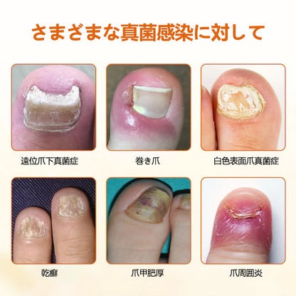 CleraNaure® FungiBee Advanced ネイルリペアスプレー🌟