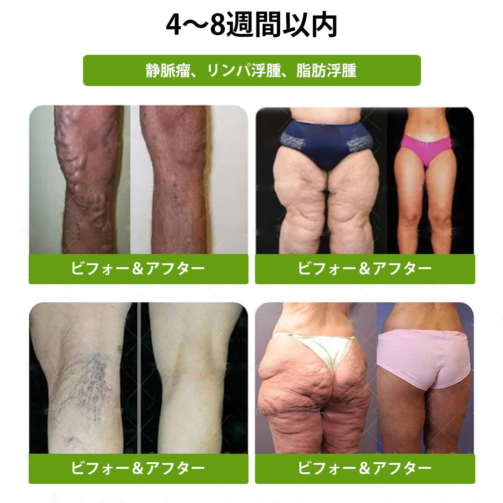 CleraNaure® Glumasetide 8-in-1 スリム＆ヘルシー・ナノマイクロニードルパッチ（1日1回使用 — 最短7日で変化を実感） ✅ 肥満、肌の引き締め、糖尿病、睡眠時無呼吸症候群、関節の悩みなどに。-🌿