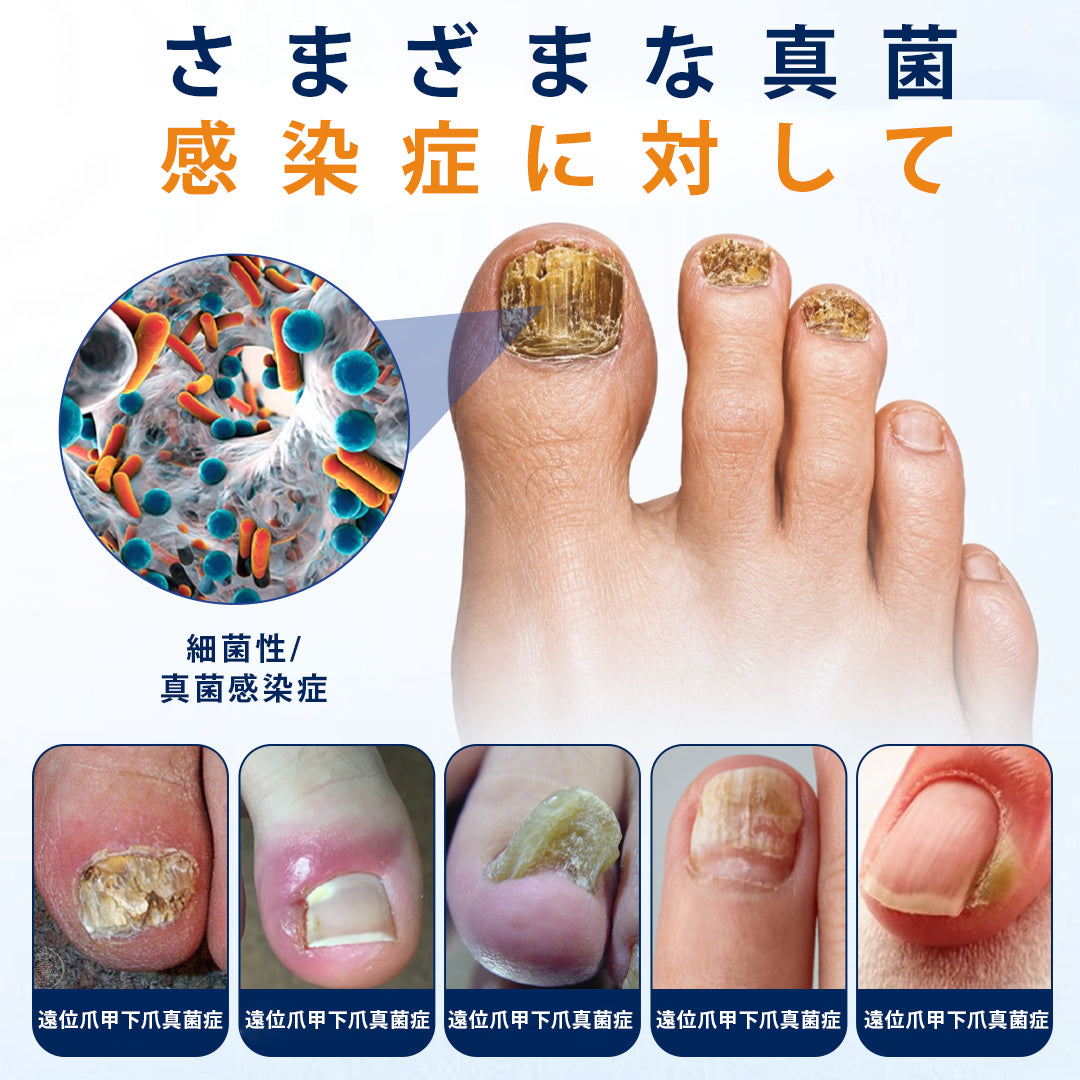 CleraNaure® 爪水虫緩和スプレー