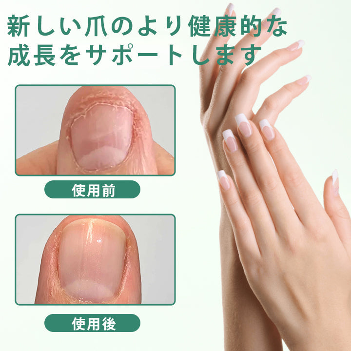 CleraNaure® ネイルディトックス 浸透セラムペン