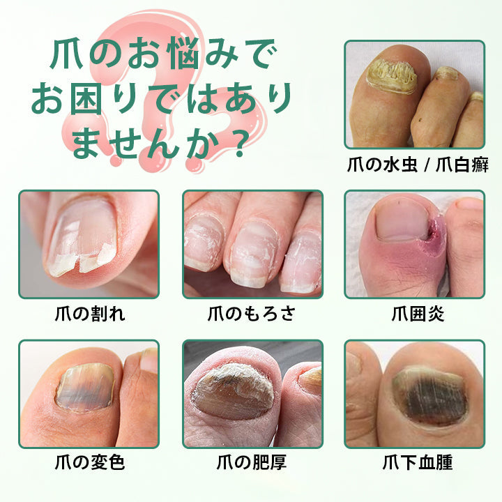 CleraNaure® ネイルディトックス 浸透セラムペン
