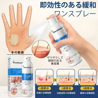 CleraNaure® マグネシウム＆ボタニカルスプレー – 乾癬・湿疹にアプローチする先進のスキンリカバリー | ステロイドフリーで即効鎮静