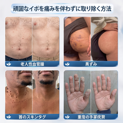 薬剤師もおすすめ💛 𝑯𝗲𝙖𝐥𝒓𝗶𝙯𝗲® 7日間 タグ＆スポットイレーサー🪄 （痛みゼロ・傷あとゼロを目指すローラーボールタイプ）👩‍⚕️